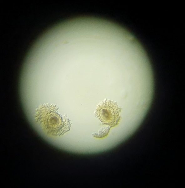 ovocytes