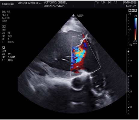 echocardio